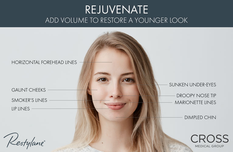 There are many uses for Restylane® at the Philadelphia area's Cross Medical Group.
